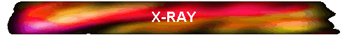 X-RAY